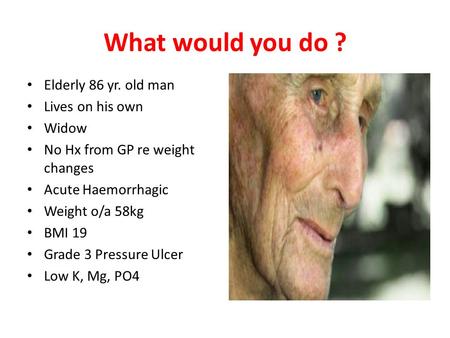 What would you do ? Elderly 86 yr. old man Lives on his own Widow No Hx from GP re weight changes Acute Haemorrhagic Weight o/a 58kg BMI 19 Grade 3 Pressure.