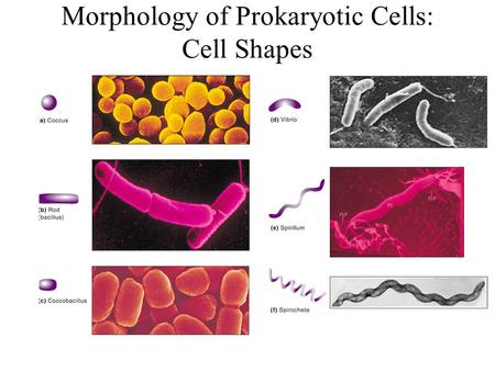 DETAILED DIFFERENCES BETWEEN EUKARYOTIC AND PROKARYOTIC CELLS Essay Sample