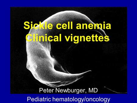 Sickle cell anemia Clinical vignettes
