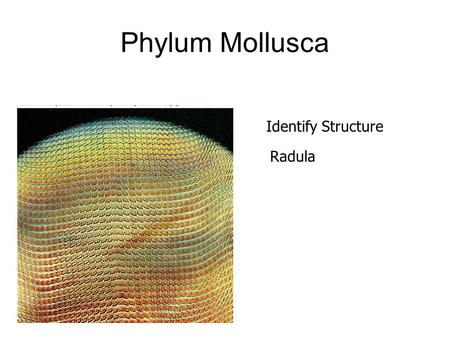 Phylum Mollusca Identify Structure Radula.