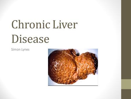 Chronic Liver Disease Simon Lynes. Definition Progressive destruction and regeneration of the liver parenchyma leading to fibrosis and cirrhosis.