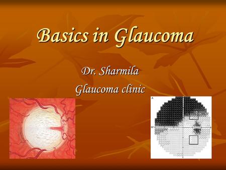 Dr. Sharmila Glaucoma clinic