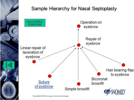 Copyright © 2001 College of American Pathologists Sample Hierarchy for Nasal Septoplasty Hair bearing flap to eyebrow Repair of eyebrow Operation on eyebrow.