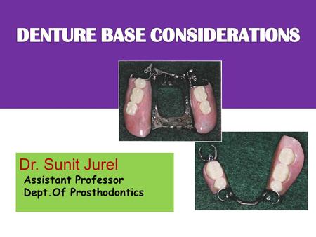 Dr. Sunit Jurel Assistant Professor Dept.Of Prosthodontics.