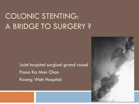 Colonic stenting: a bridge to surgery ?