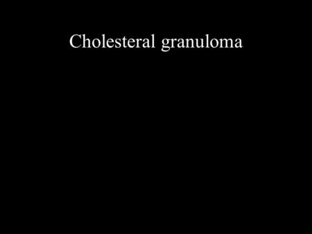 Cholesteral granuloma