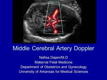Middle Cerebral Artery Doppler