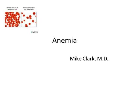 Anemia Mike Clark, M.D..