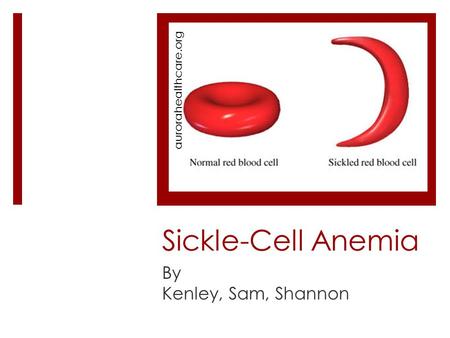 Sickle-Cell Anemia By Kenley, Sam, Shannon aurorahealthcare.org.