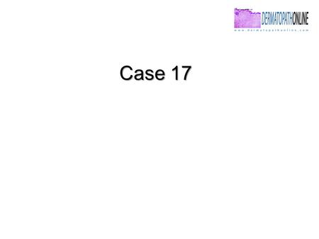 Case 17. * Female, 6 years old. * Annular lesions in both legs from one month.