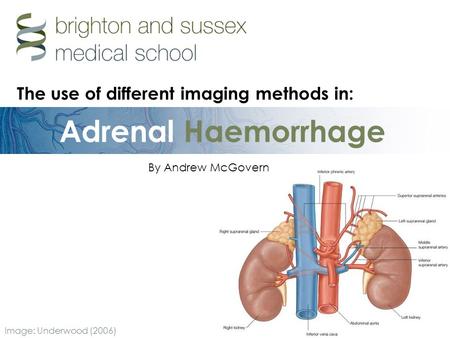 Adrenal Haemorrhage By Andrew McGovern Image: Underwood (2006) The use of different imaging methods in: