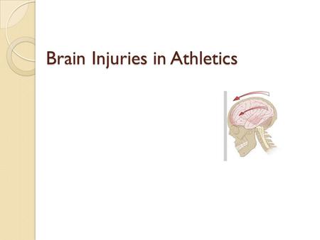 Brain Injuries in Athletics. Objectives Define and explain these terms: ◦ Concussion ◦ MTBI ◦ Second-Impact Syndrome ◦ Post-Concussion Syndrome ◦ Intracranial.