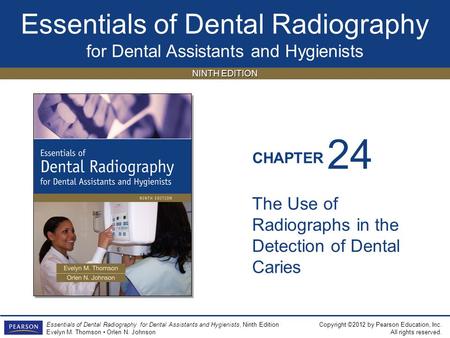 24 The Use of Radiographs in the Detection of Dental Caries.