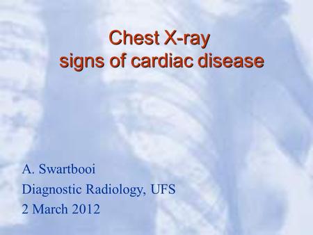 Chest X-ray signs of cardiac disease