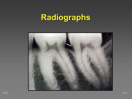 AHCJYS Radiographs. AHCJYS Intra-oral radiographic information Root lengthRoot length Root proximityRoot proximity Root formRoot form Presence or absence.