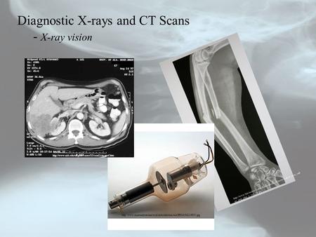 Diagnostic X-rays and CT Scans - X-ray vision