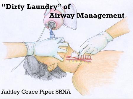 “Dirty Laundry” of Airway Management Ashley Grace Piper SRNA.
