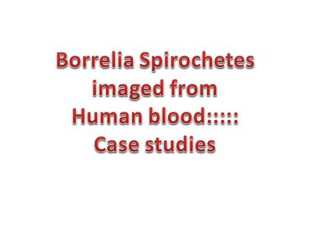 Darkfield Microscopy 1000x oil immersion darkfield condenser Motile Borrelia burgdorferi Spirochete in Fresh Blood, with background of Erythrocytes,