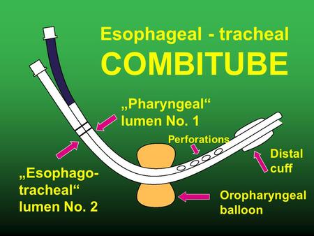 „Pharyngeal“ lumen No. 1 „Esophago- tracheal“ lumen No. 2 Esophageal - tracheal COMBITUBE Oropharyngeal balloon Distal cuff Perforations.