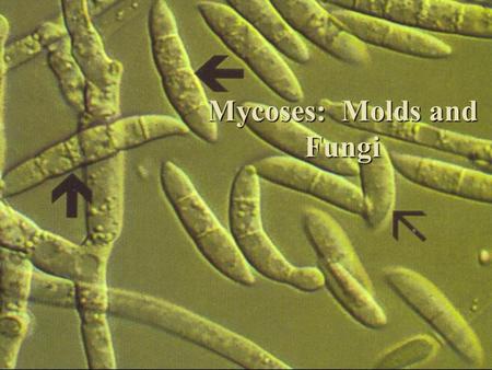 Mycoses: Molds and Fungi. Introductory Comments  Fungi are members of the Kingdom Thallophyta  main characteristic: no chlorophyll  responsible for.
