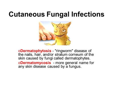 Cutaneous Fungal Infections