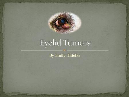 Eyelid Tumors By Emily Thielke.
