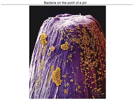 Bacteria on the point of a pin. Archaebacteria & Eubacteria prokaryotic cells Abundant –Ex: in the human body- for every one human cell there are 10 prokaryotic.