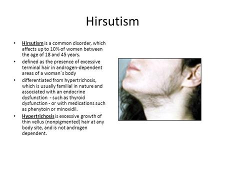 Hirsutism Hirsutism is a common disorder, which affects up to 10% of women between the age of 18 and 45 years. defined as the presence of excessive terminal.