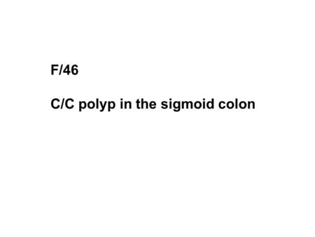 F/46 C/C polyp in the sigmoid colon. V/S BP 120/80 mmHg HR 84/min ROS melena/hematochezia (-/-) bowel habit change (-) bearing down sensation PMHx. hemorrhoidectomy,