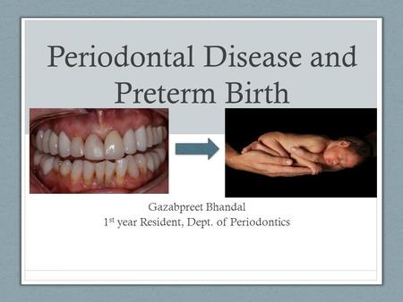 Periodontal Disease and Preterm Birth Gazabpreet Bhandal 1 st year Resident, Dept. of Periodontics.