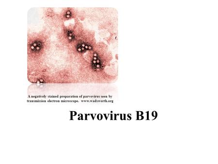 Parvovirus B19 A negatively stained preparation of parvovirus seen by transmission electron microscope. www.wadsworth.org.