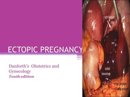 Danforth’s Obstetrics and Gynecology Tenth edition