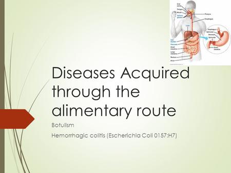 Diseases Acquired through the alimentary route Botulism Hemorrhagic colitis (Escherichia Coli 0157:H7)