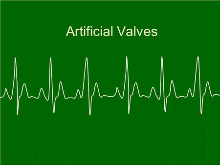 Artificial Valves. In this activity you will be able to see for yourself the way in which a valve works. This activity will offer: An opportunity to build.