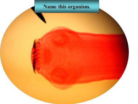 Name this organism.. tapeworm Name the phylum Platyhelminthes.