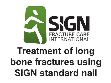 Treatment of long bone fractures using SIGN standard nail.