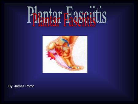 By: James Porco. Plantar fasciitis is the most common cause of heel pain. The plantar fascia is the ligament that connects your calcaneous (heel bone)