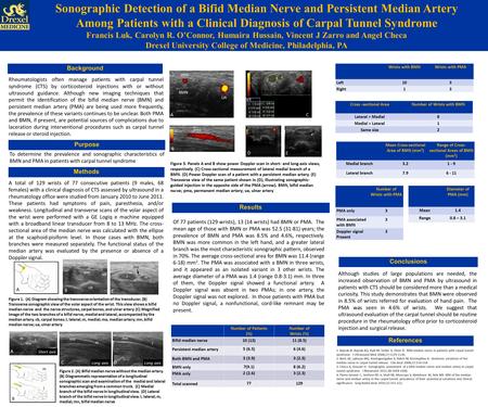 Sonographic Detection of a Bifid Median Nerve and Persistent Median Artery Among Patients with a Clinical Diagnosis of Carpal Tunnel Syndrome Francis Luk,