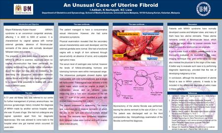 TEMPLATE DESIGN © 2008 www.PosterPresentations.com An Unusual Case of Uterine Fibroid I Adibah, K Norhayati, KC Liew Department of Obstetrics and Gynaecology,