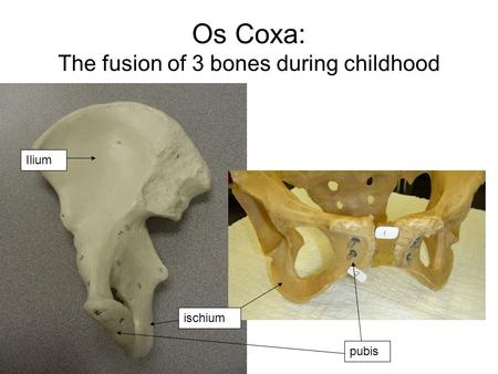 Os Coxa: The fusion of 3 bones during childhood