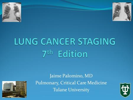 Jaime Palomino, MD Pulmonary, Critical Care Medicine Tulane University.