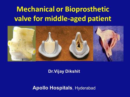 Mechanical or Bioprosthetic valve for middle-aged patient Dr.Vijay Dikshit Apollo Hospitals, Hyderabad.