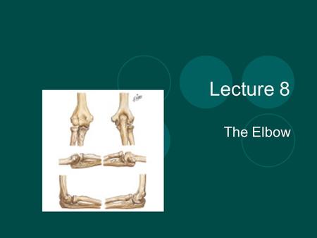 Lecture 8 The Elbow. Anatomy Review The elbow is made up of three joints -Humeroulnar jointFlexion / Extension -Humeroradial jointFlexion / Extension.