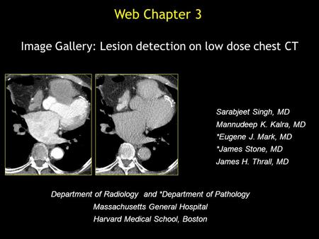Image Gallery: Lesion detection on low dose chest CT Sarabjeet Singh, MD Mannudeep K. Kalra, MD *Eugene J. Mark, MD *James Stone, MD James H. Thrall, MD.