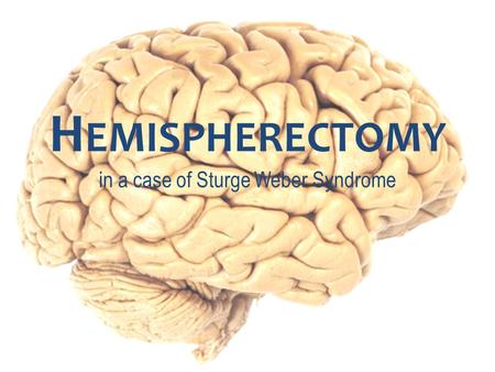 H EMISPHERECTOMY in a case of Sturge Weber Syndrome.