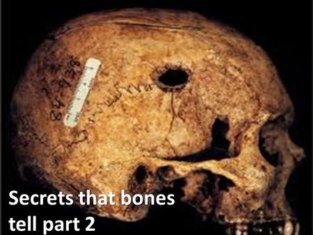 Secrets that bones tell part 2. Determining Age from Bones How did researchers determine the age of ‘the crossbones girl’? What other ways do our bones.