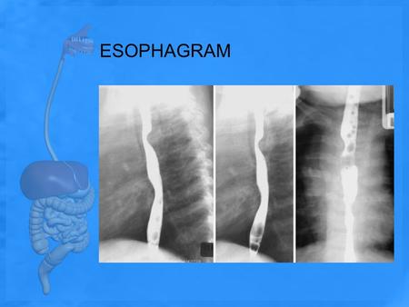 ESOPHAGRAM.