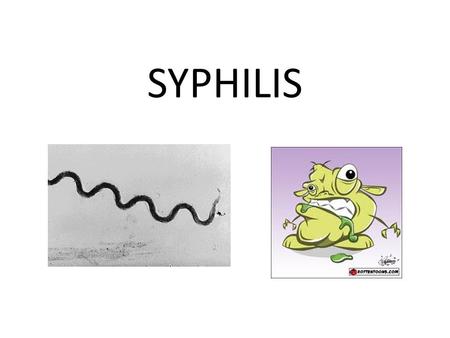 SYPHILIS. Why syphilis? BACKGROUND Treponema pallidum (spiralled spirochaete) First epidemic in Europe in 15 century Incubation – 10-90 days (average.