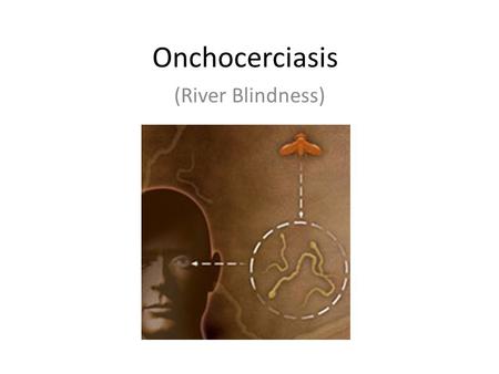 Onchocerciasis (River Blindness). River Blindness, a parasitic disease, is the second leading infectious cause of blindness.