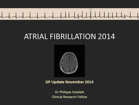 ATRIAL FIBRILLATION 2014 GP Update November 2014 Dr Philippa Howlett Clinical Research Fellow.